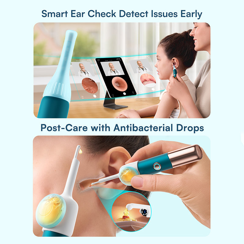 Herramienta para eliminar cerumen con cámara