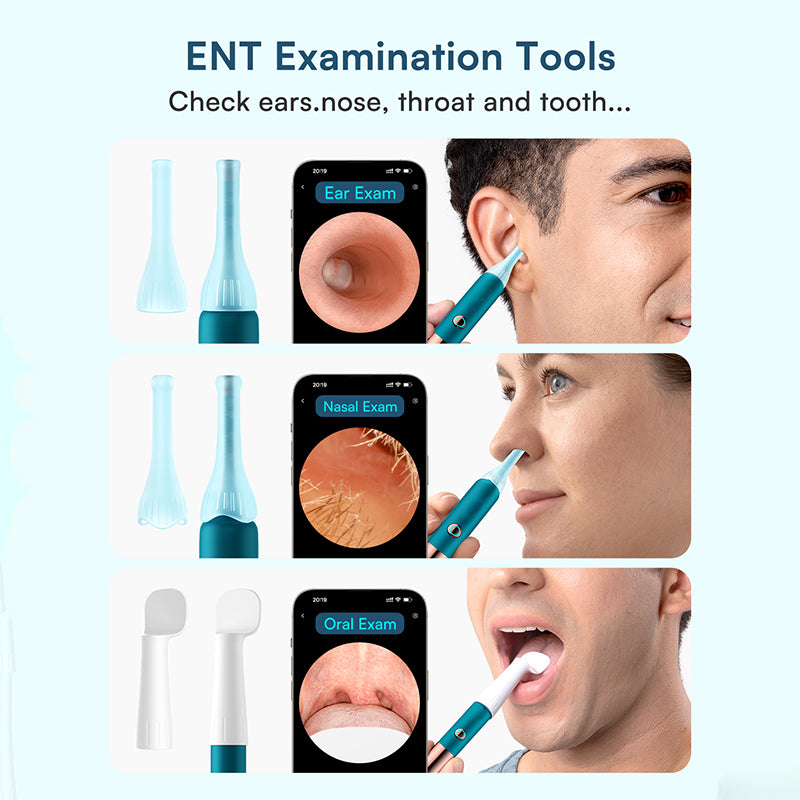 Herramienta para eliminar cerumen con cámara
