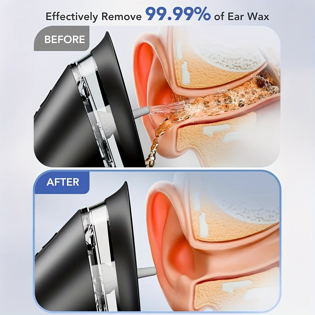 Extractor eléctrico de cerumen, limpiador con USB recargable y sistema de agua