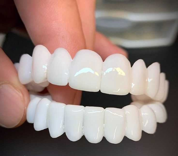 Carillas dentales estéticas profesionales para una sonrisa segura y bonita