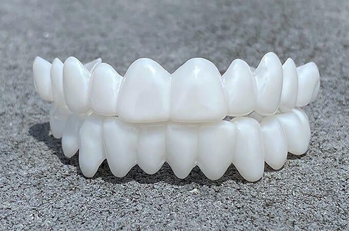 Carillas dentales estéticas profesionales para una sonrisa segura y bonita