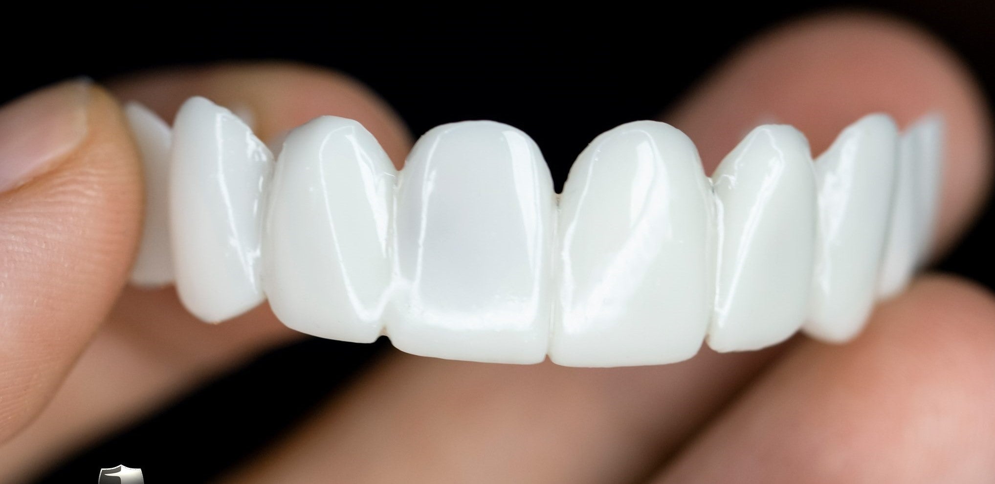 Carillas dentales estéticas profesionales para una sonrisa segura y bonita