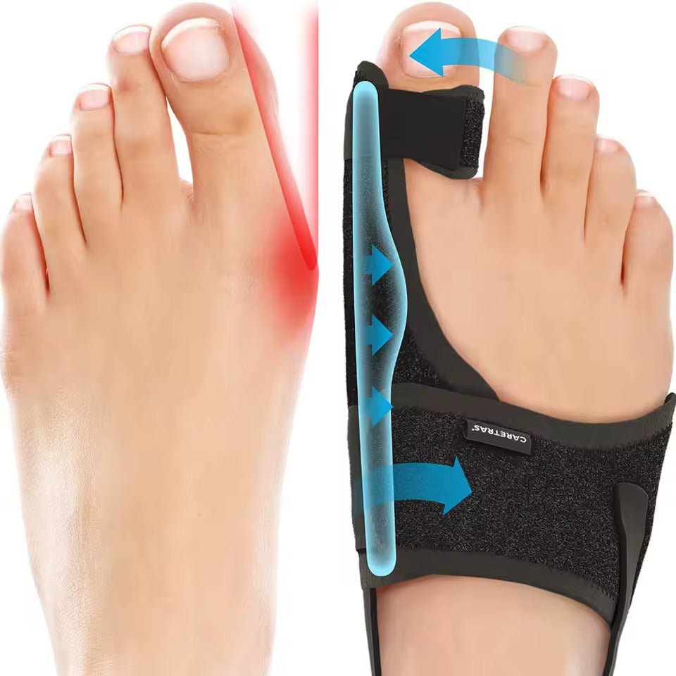 Férula nocturna para juanetes - Ergonómica y ajustable