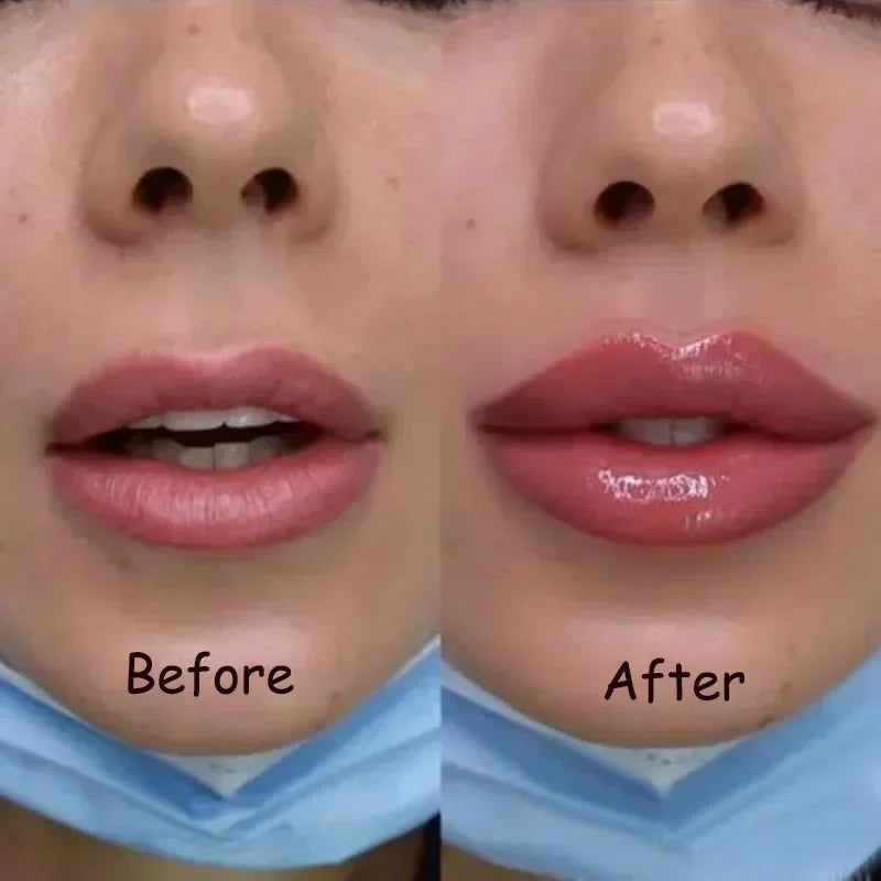 Sérum voluminizador de labios LumaGlow para labios más carnosos en minutos