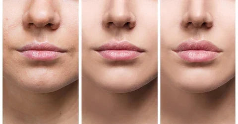 Sérum voluminizador de labios LumaGlow para labios más carnosos en minutos