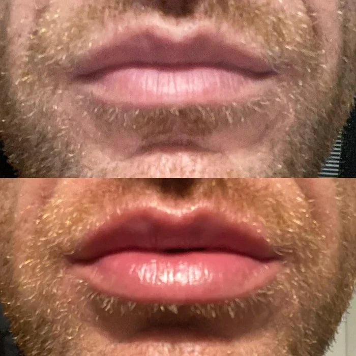 Sérum voluminizador de labios LumaGlow para labios más carnosos en minutos