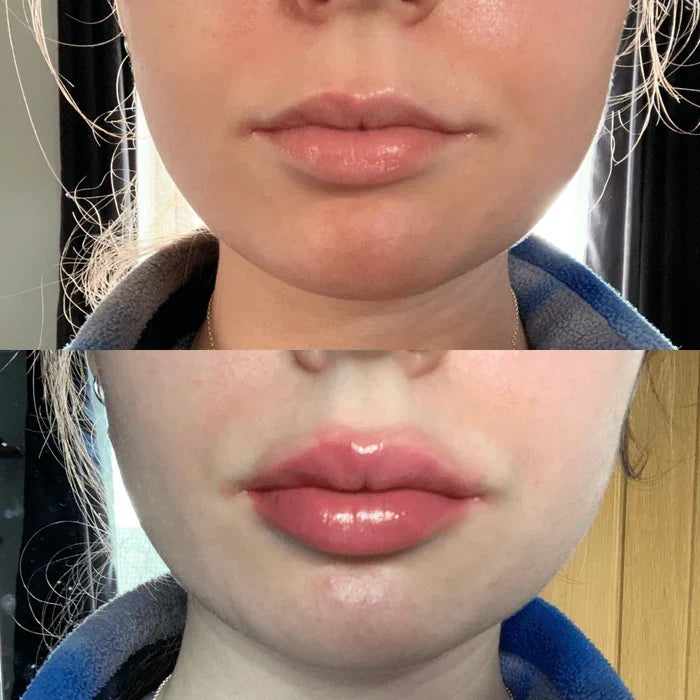 Sérum voluminizador de labios LumaGlow para labios más carnosos en minutos