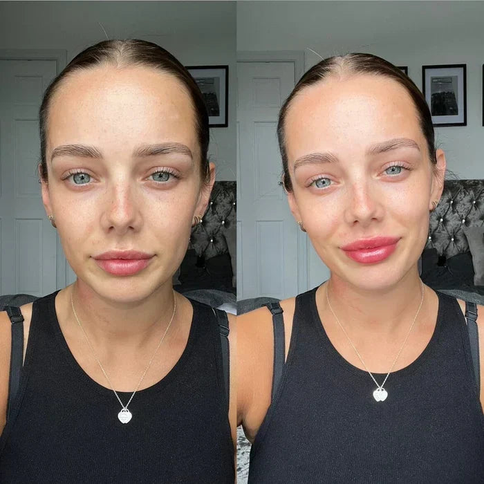 Sérum voluminizador de labios LumaGlow para labios más carnosos en minutos