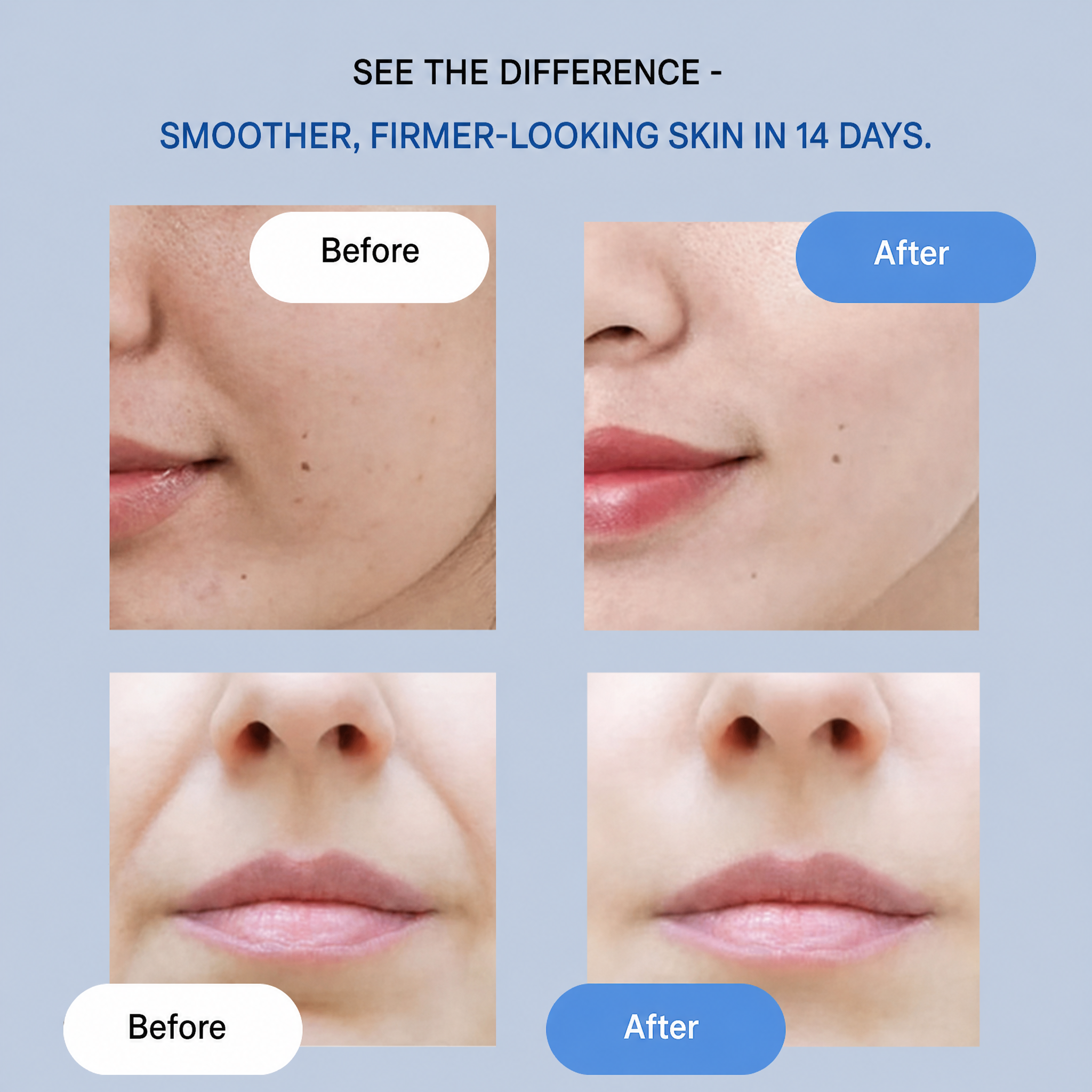 Tiras faciales efecto lifting | Alisa y reafirma al instante | Cuidado antiarrugas sin cirugía | YouthLift Renew