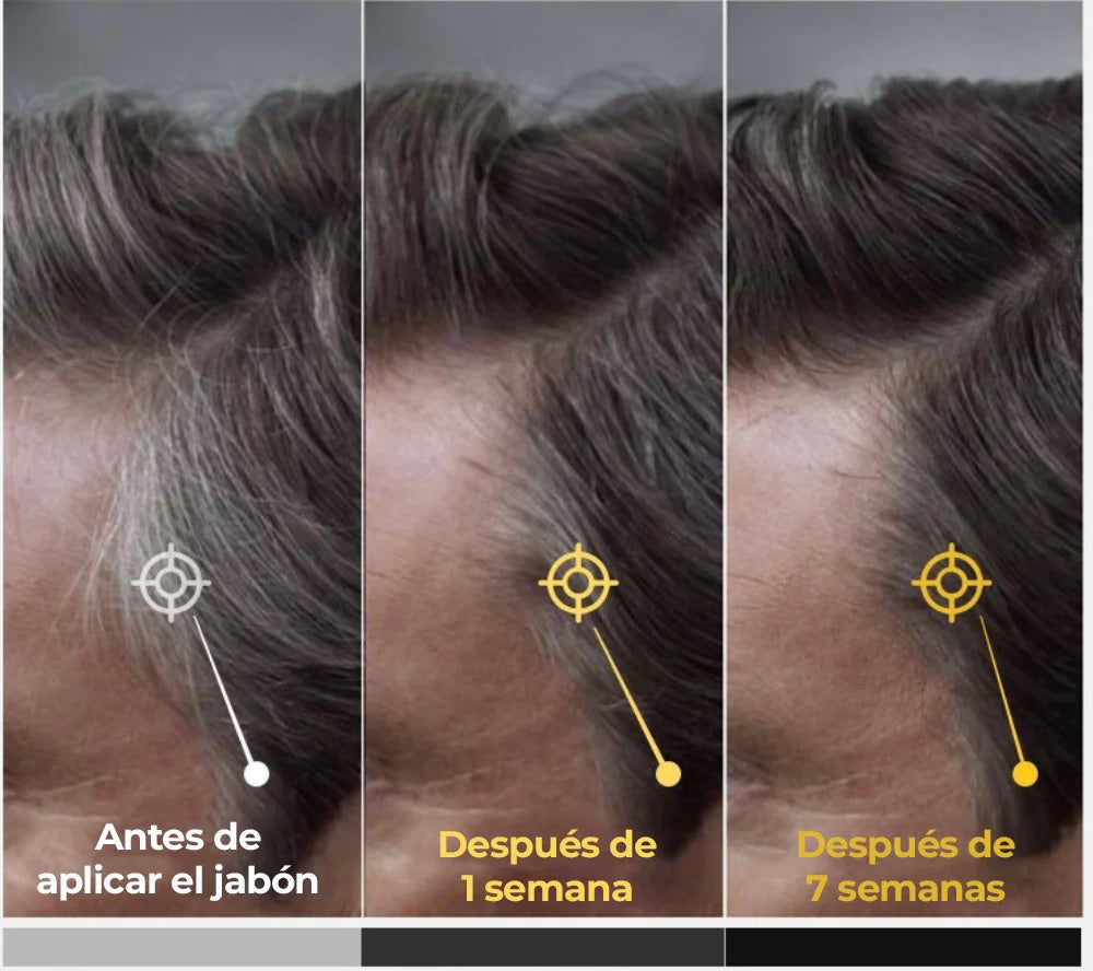 Jabon anti canas | Dmax